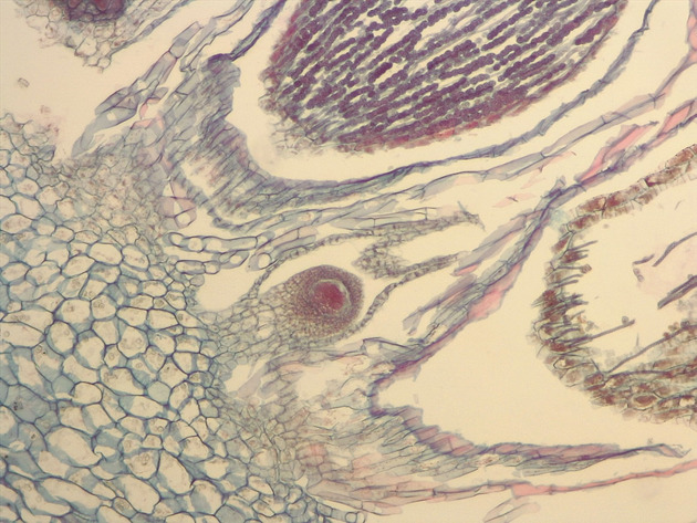 Liverwort Sporophyte Slides - Liverwort Sporophyte 03 100X